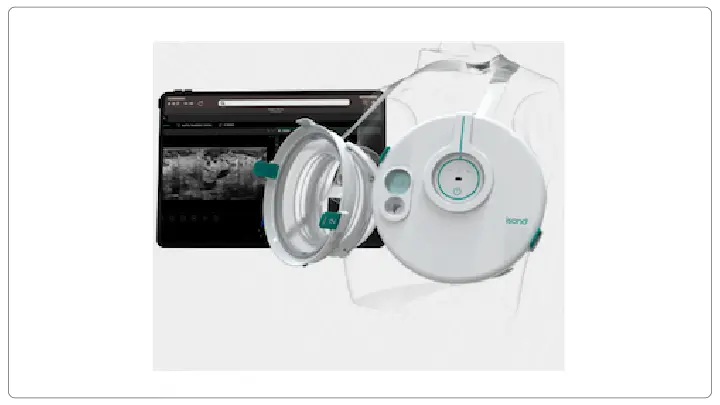 3D Breast Ultrasound