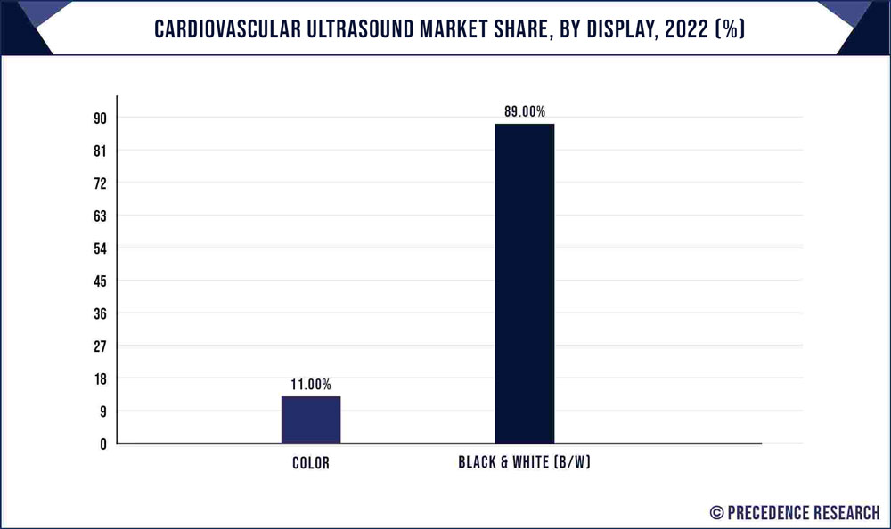Cardiovascular Ultrasound Market Share, By Display, 2021 (%)