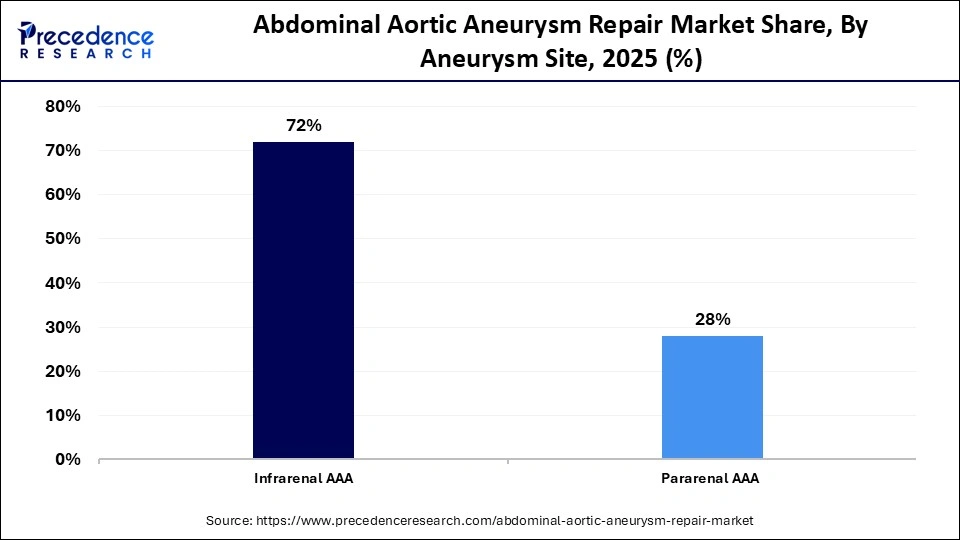 Abdominal Aortic Aneurysm Repair Market Share, By Aneurysm Site, 2025 (%)