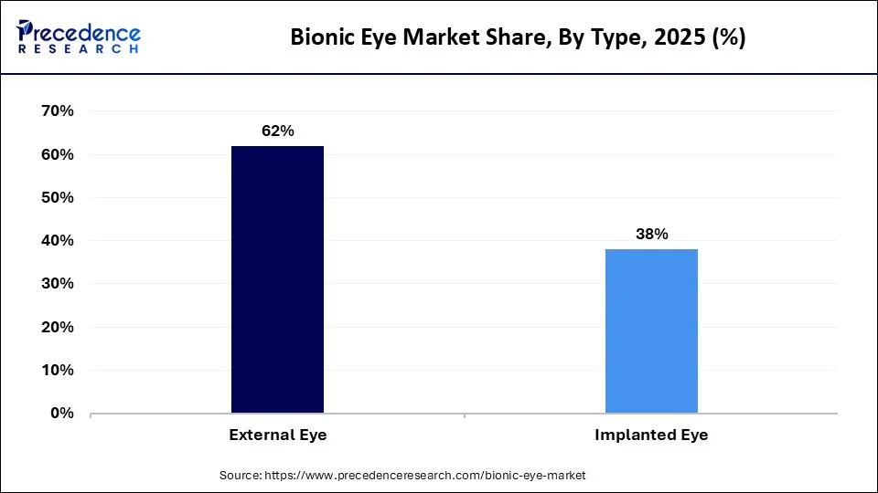 Bionic Eye Market Share, By Type, 2022 (%)