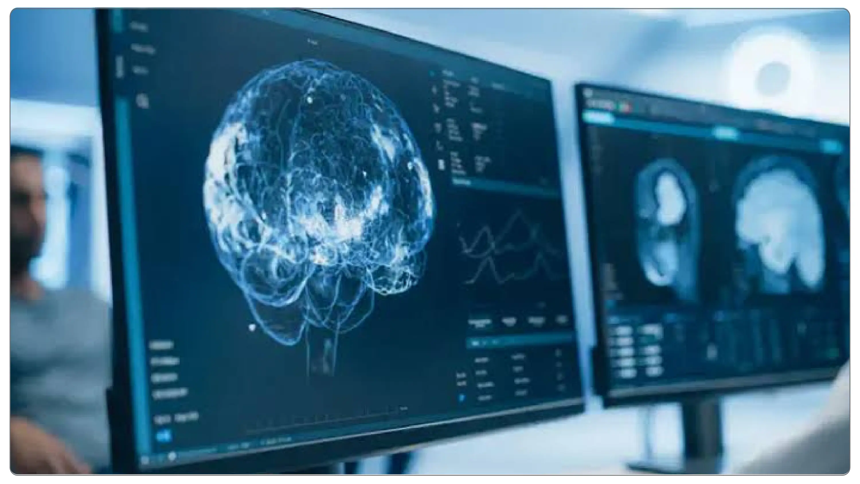 IQ Testing Technology IQ Testing Technology