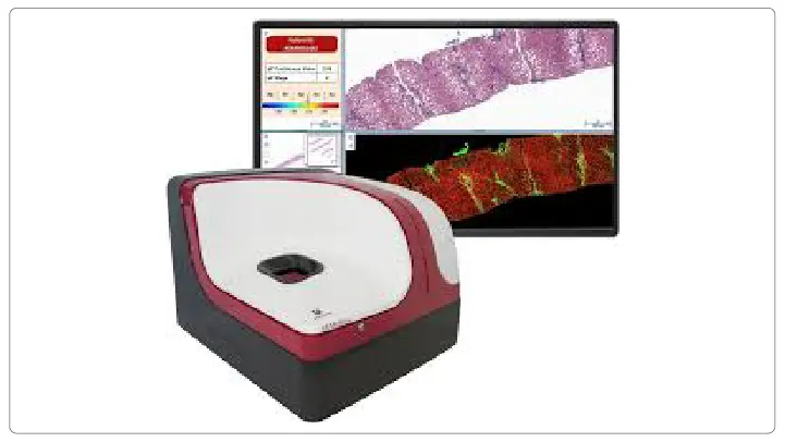 MASH Fibrosis