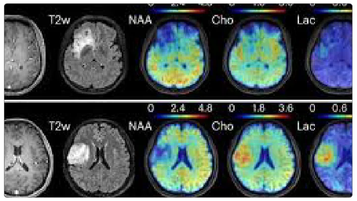 MRI Technology