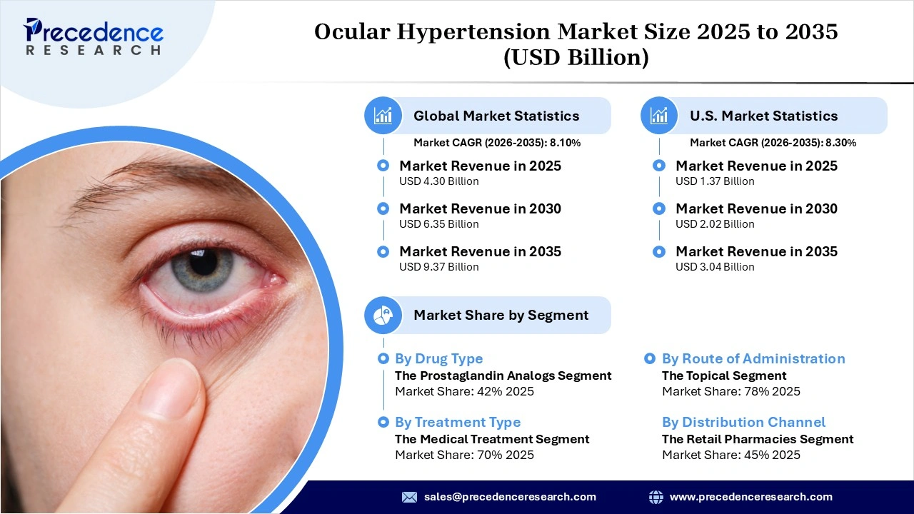 Ocular Hypertension Market Revenue Statistics