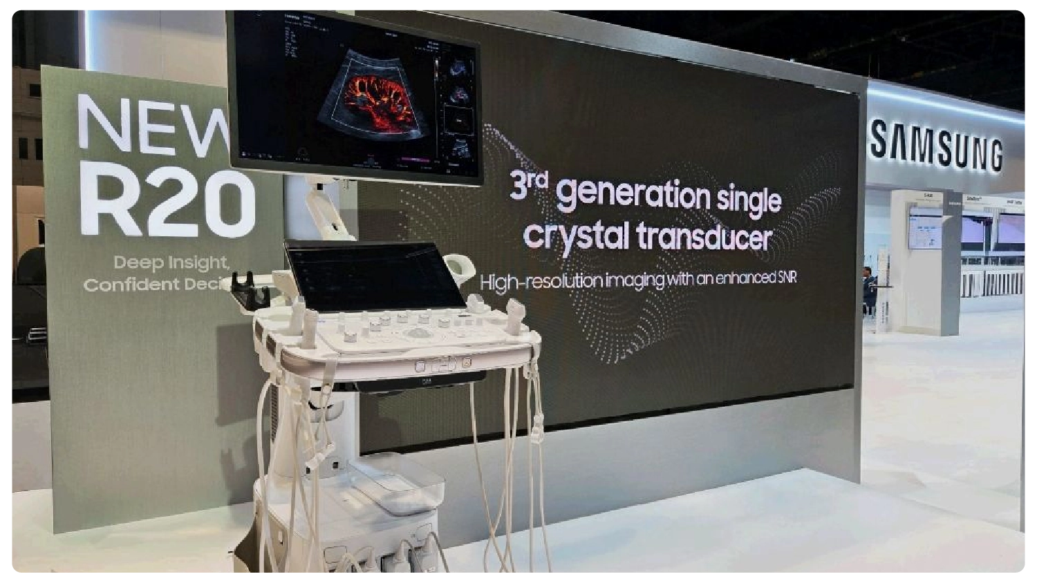 R20 Ultrasound System