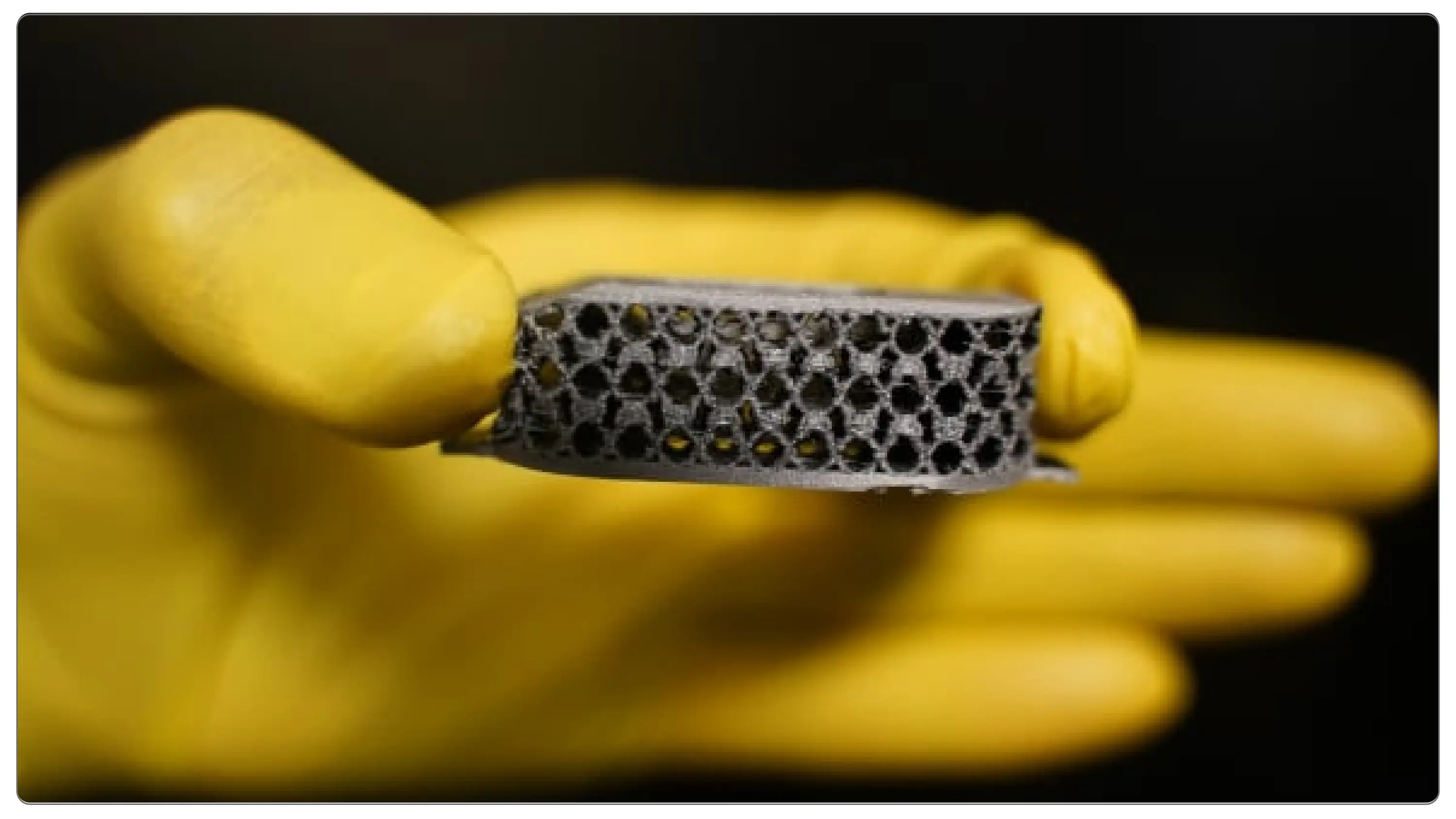 Smart Metal Implant Smart Metal Implant