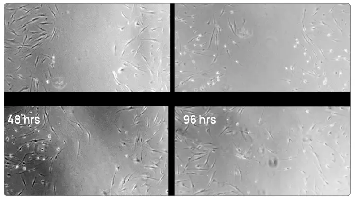 StemCells