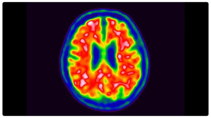 Ultra-Sensitive Alzheimer&rsquo;s Detection