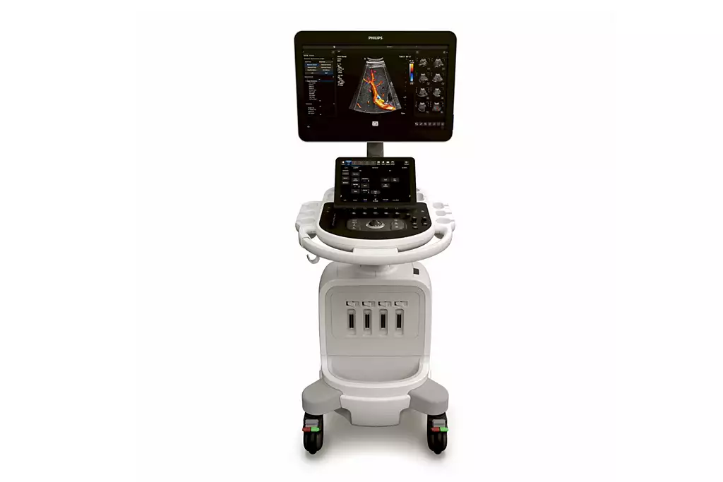 Ultrasound System 